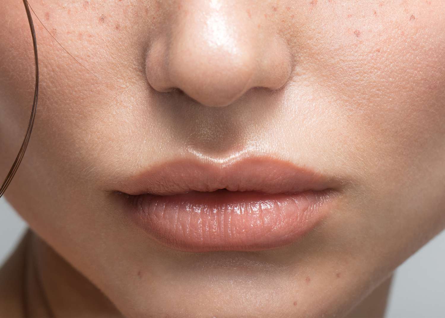 Subtle natural lip filler enhancement on fair skin – perfect symmetry